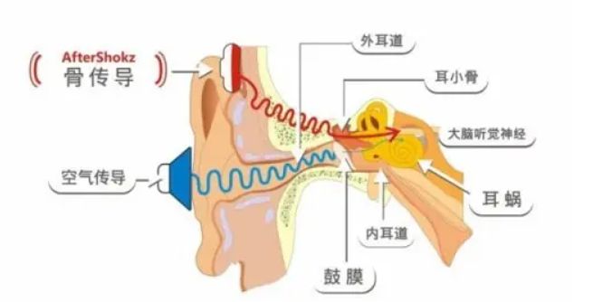 什么是骨传导耳机？有什么优缺点！-微丽宝（丽宝云）